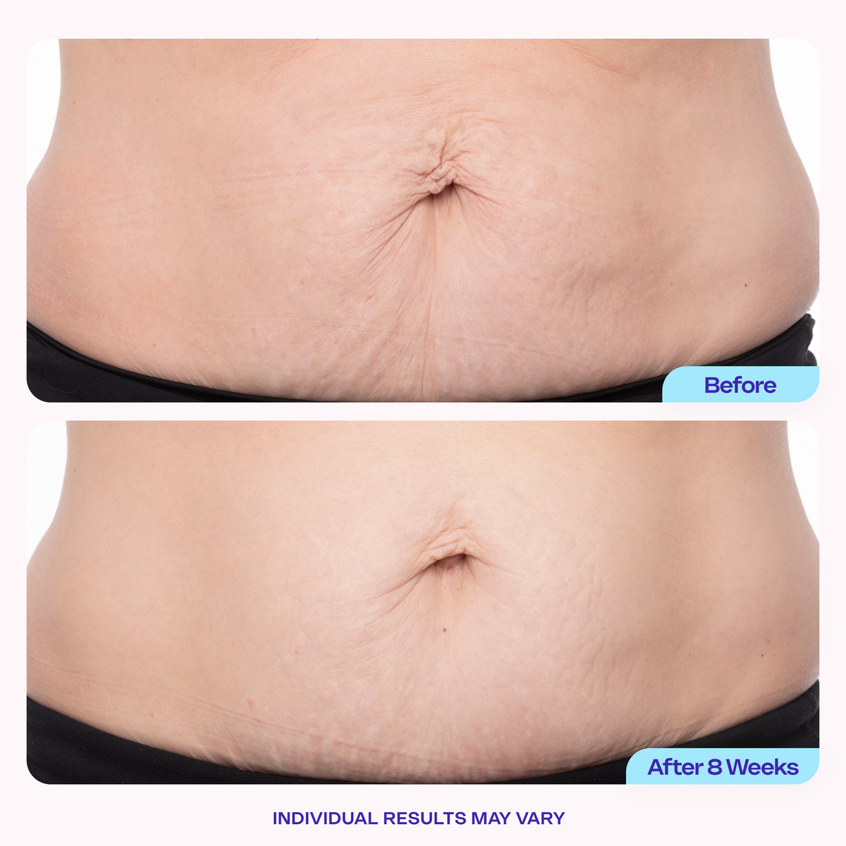 Tighter & Smoother Belly Cream