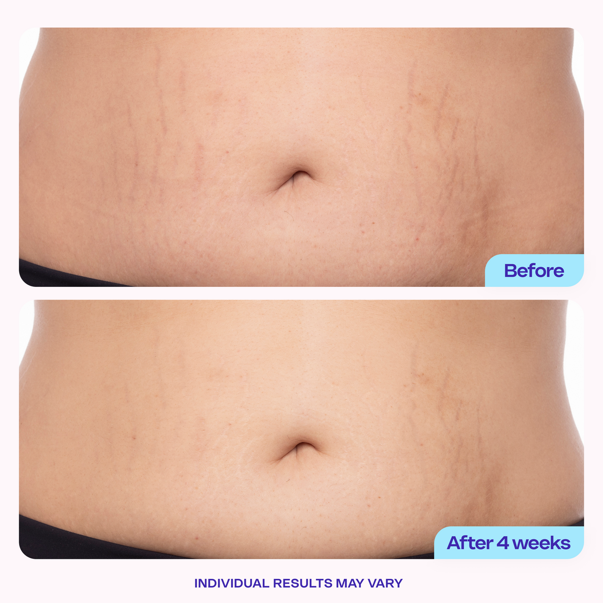 Tighter & Smoother Belly Cream