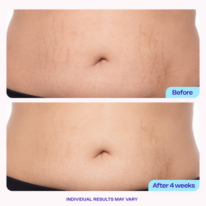 Tighter & Smoother Belly Cream